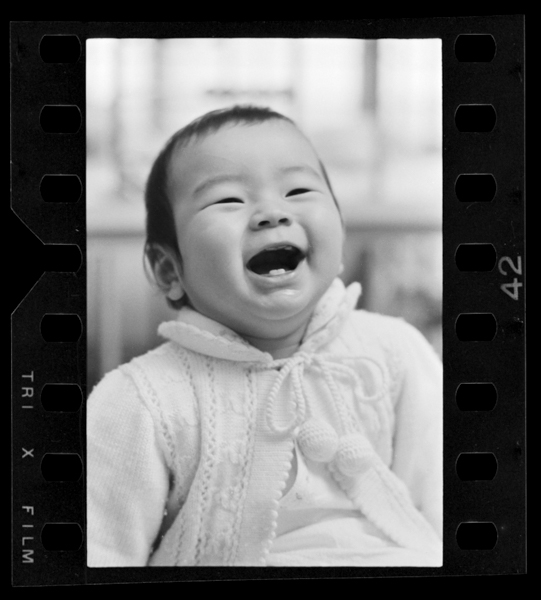 315日 上の歯が見える